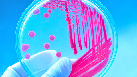 What’s the Difference Between Resident and Transient Strains?
